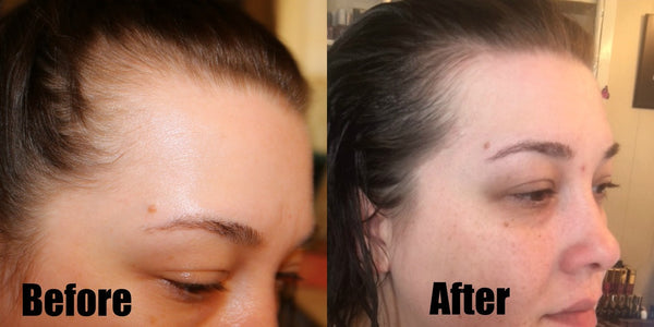 Picture showing hair growth