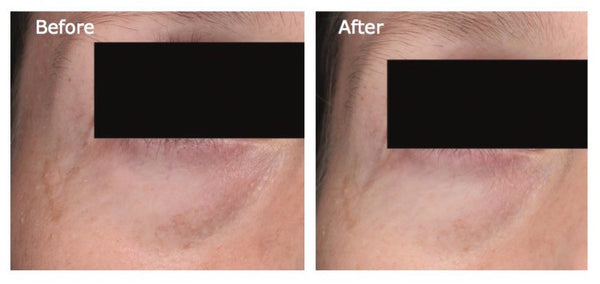 Protect your skin from polluted air