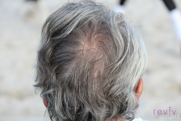 All about Darkenyl in RevivHair REV Advanced