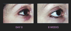 Regu-Age reduces visibility of dark circles