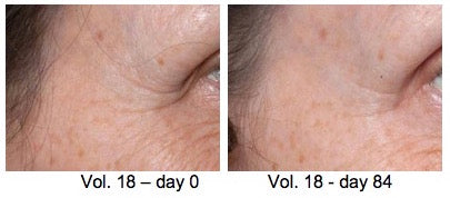 All about the remarkable Syn®-Coll peptide in Ultimate Serum