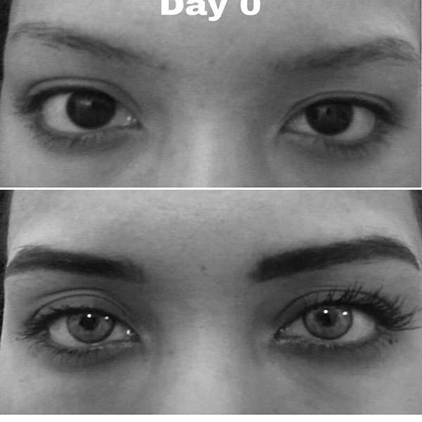 Before After RevivLash