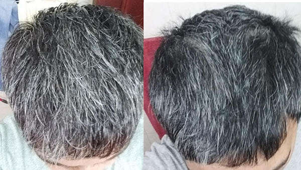 Before After Pic 2