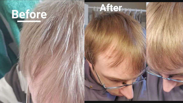 Before After Pic 4
