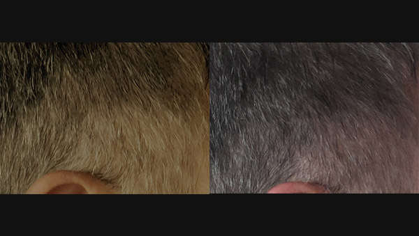 Before After Pic 1