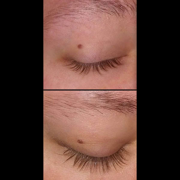 Before After RevivLash