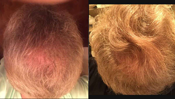 Before After Pic 3